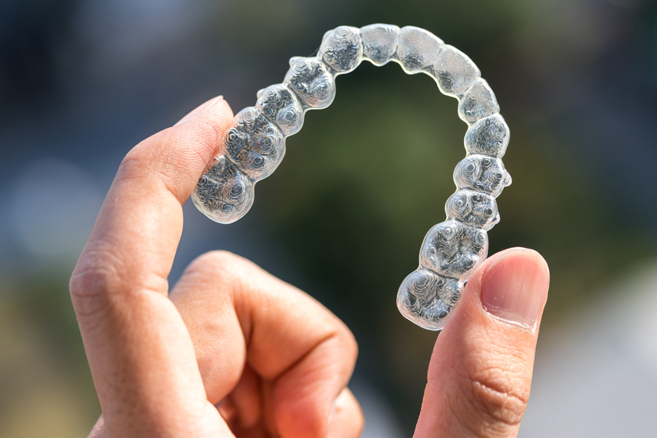 Dental Aligner